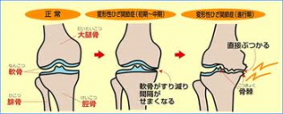 s_関節図