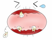 歯周病で認知症になる？