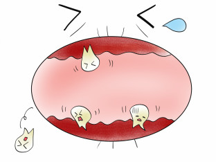 歯周病で認知症になる？