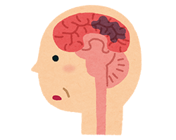 器質性認知症。普通の認知症と違うの?